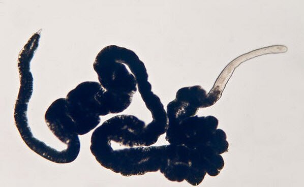 Что общего между червями без пищеварительной системы и митохондриями?