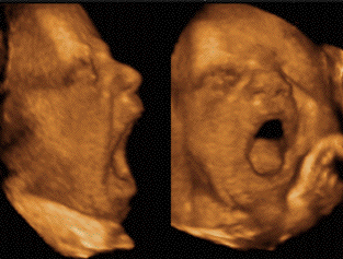 Дети зевают в утробе матери