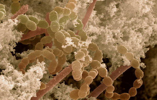Бактерии, содержащиеся в йогуртах: Streptococcus thermophilus (сферические) и Lactobacillus bulgaricus (палочковидные) (фото <noindex/><a target=_blank href=http://sciencephoto.com>Power and Syred</a>).” width=”540″ height=”345″ /></p> <table width=