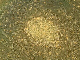 Культура эмбриональных стволовых клеток под микроскопом. Фото с сайта wikipedia.org